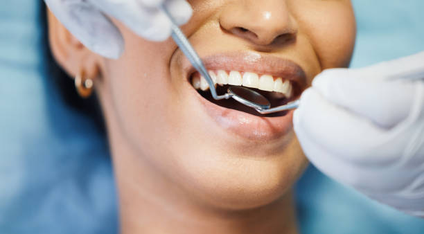 Best Urgent Care for Lost Fillings or Crowns in Manchester, MI
